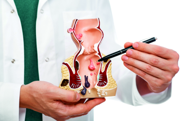 Laser Surgery for Fissure in Mohali, Fissure Treatment in Punjab, Fissurectomy, Best Surgeon for Laser Fissure Surgery in Mohali, Punjab, Cost of Laser Fissure Surgery